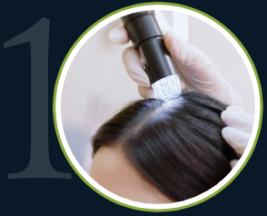 Da Vinci Hair Loss Treatment 1